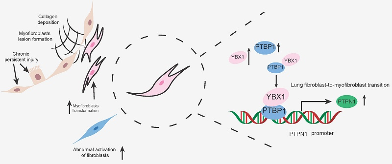 ​我校科研团队在特发性肺纤维化...