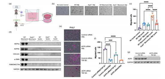 Immunology | 巨噬细胞表达的ACP5促进肺纤维化进展